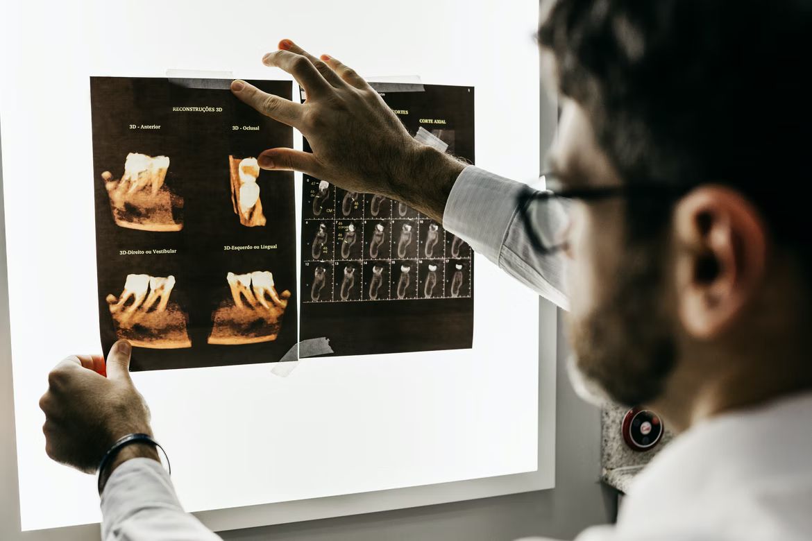 Dentist looking at dental reconstruction